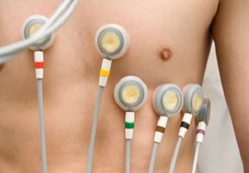 Diagnostik – EKG