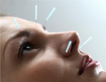 Naturmedizin – Akupunktur